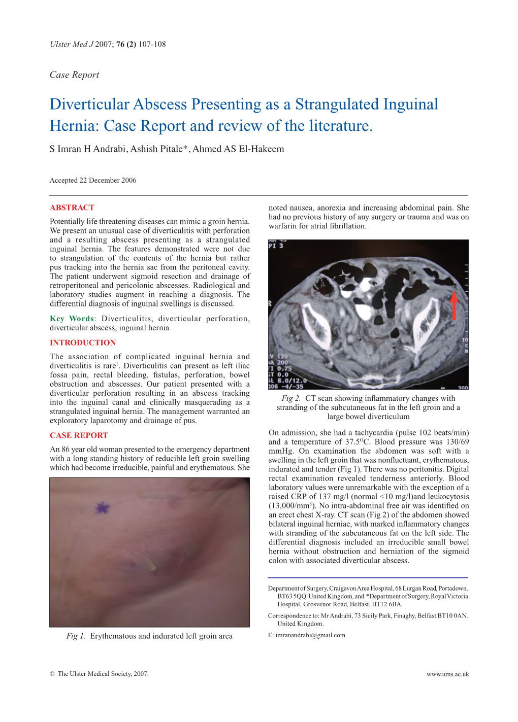 Diverticular Abscess Presenting As A Strangulated Inguinal Hernia Case