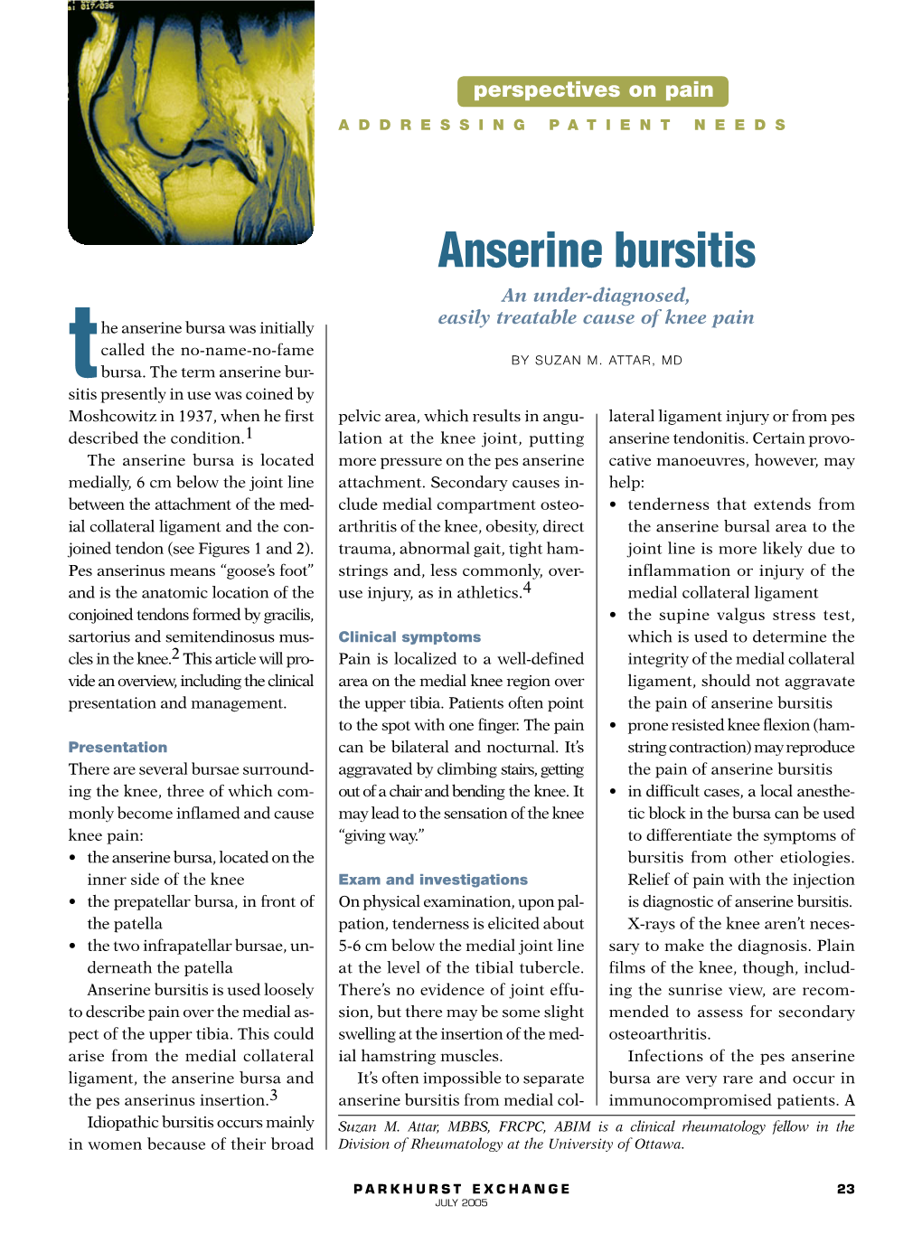 Anserine Bursitis An Under Diagnosed Easily Treatable Cause Of Knee Pain He Anserine Bursa Was