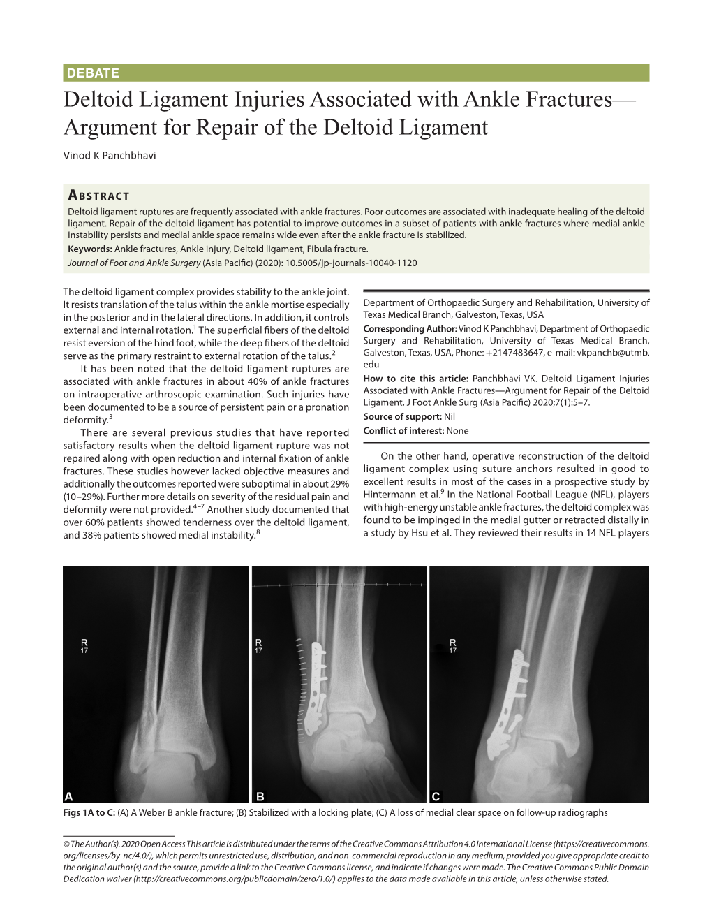 Deltoid Ligament Injuries Associated With Ankle Fractures Argument For