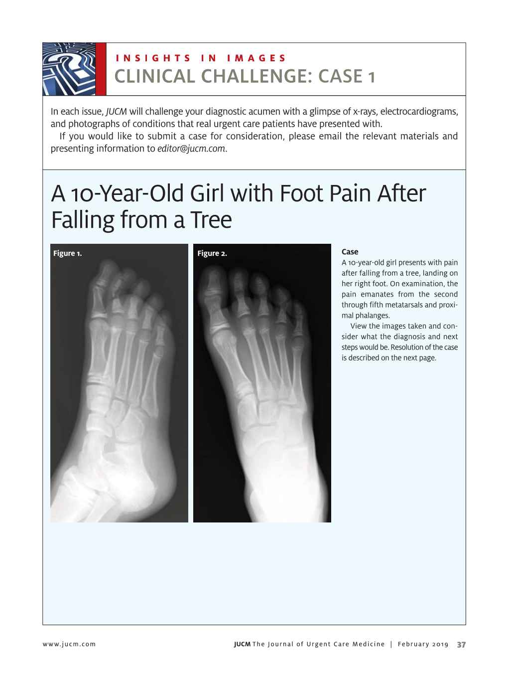 A 10-Year-Old Girl with Foot Pain After Falling from a Tree