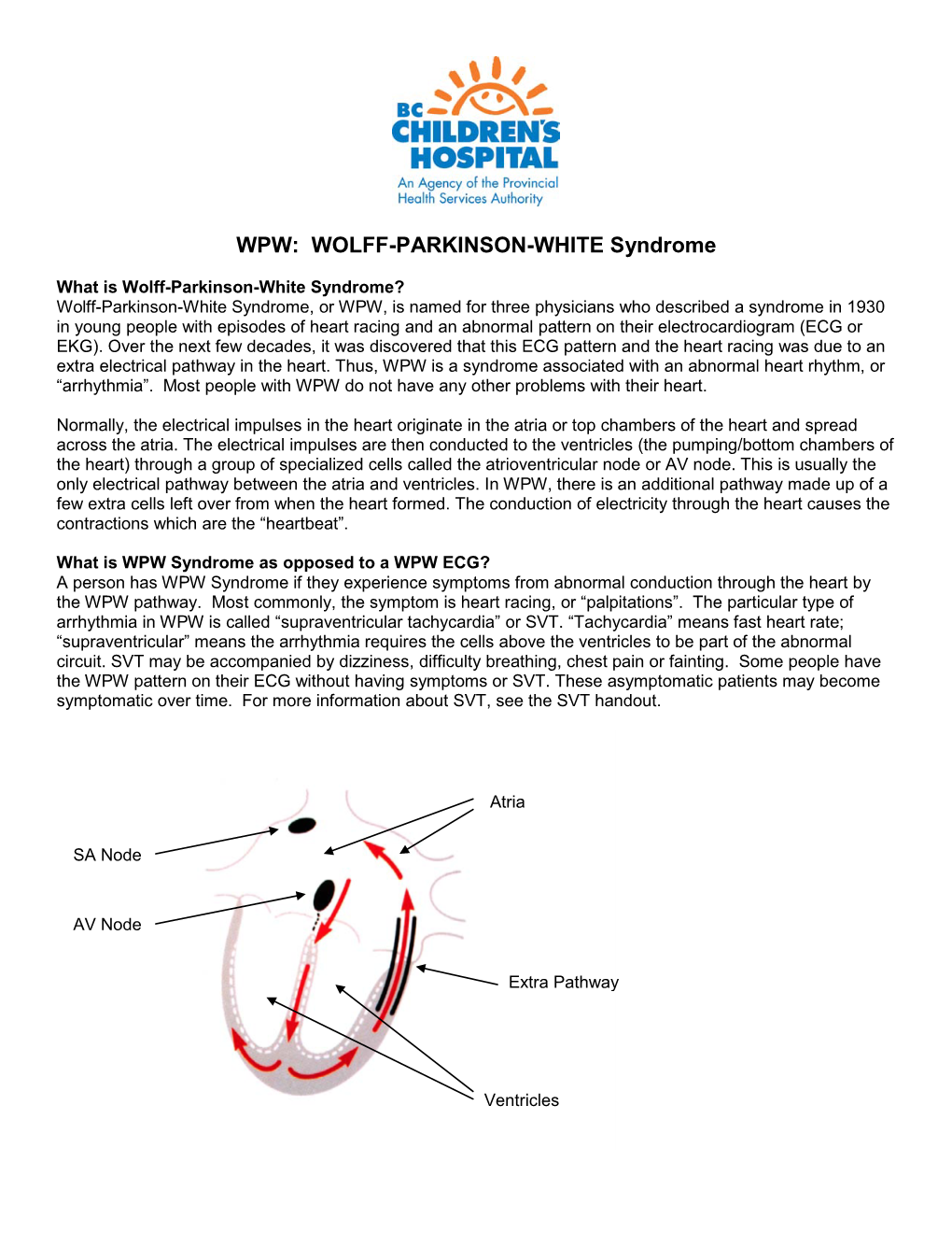 WPW: WOLFF-PARKINSON-WHITE Syndrome