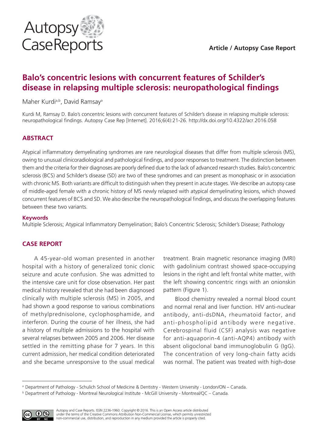 Balo's Concentric Lesions with Concurrent Features of Schilder's