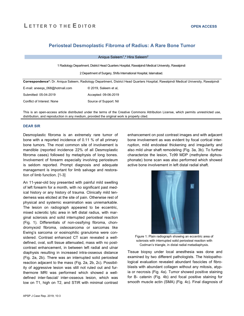 A Rare Bone Tumor