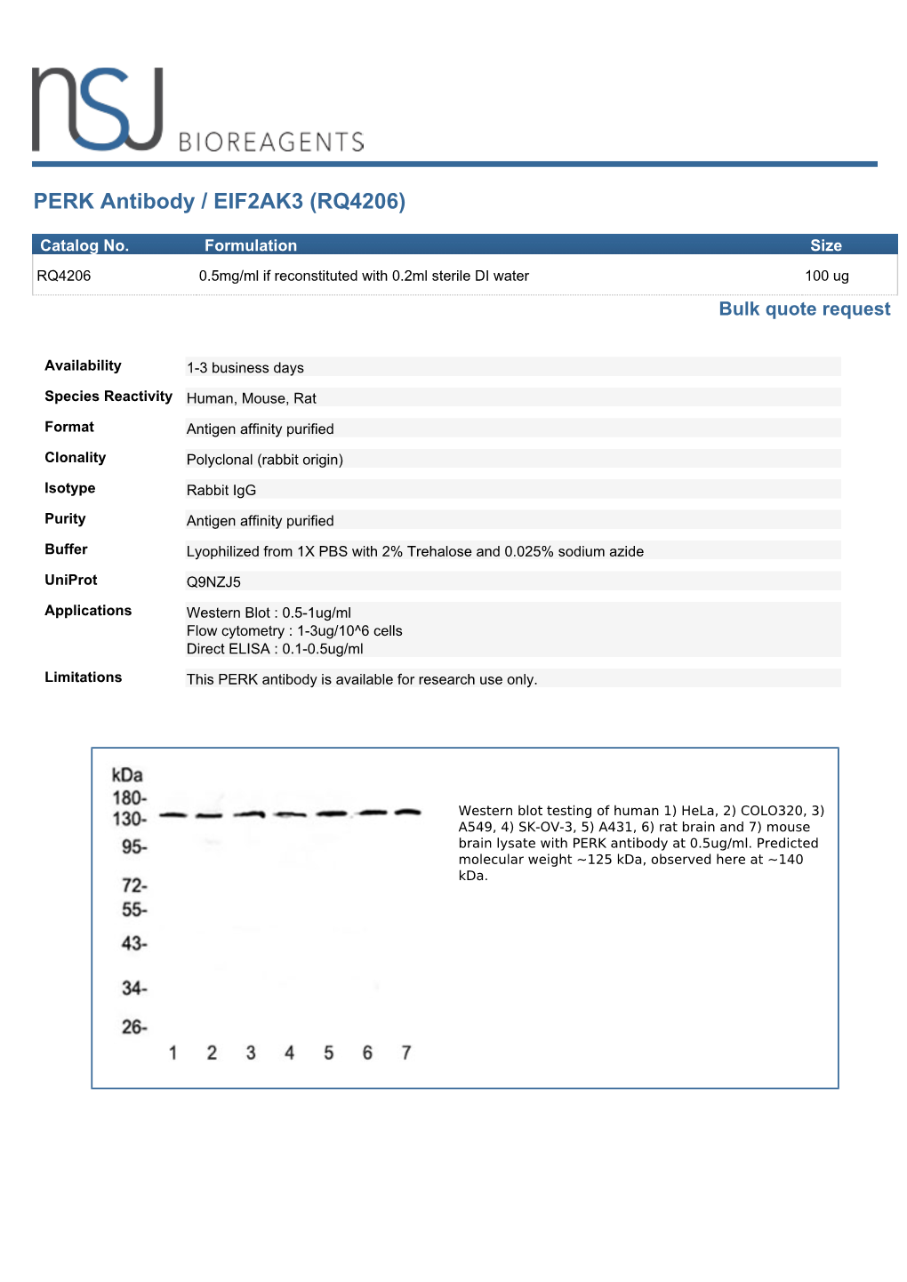 PERK Antibody / EIF2AK3 (RQ4206)