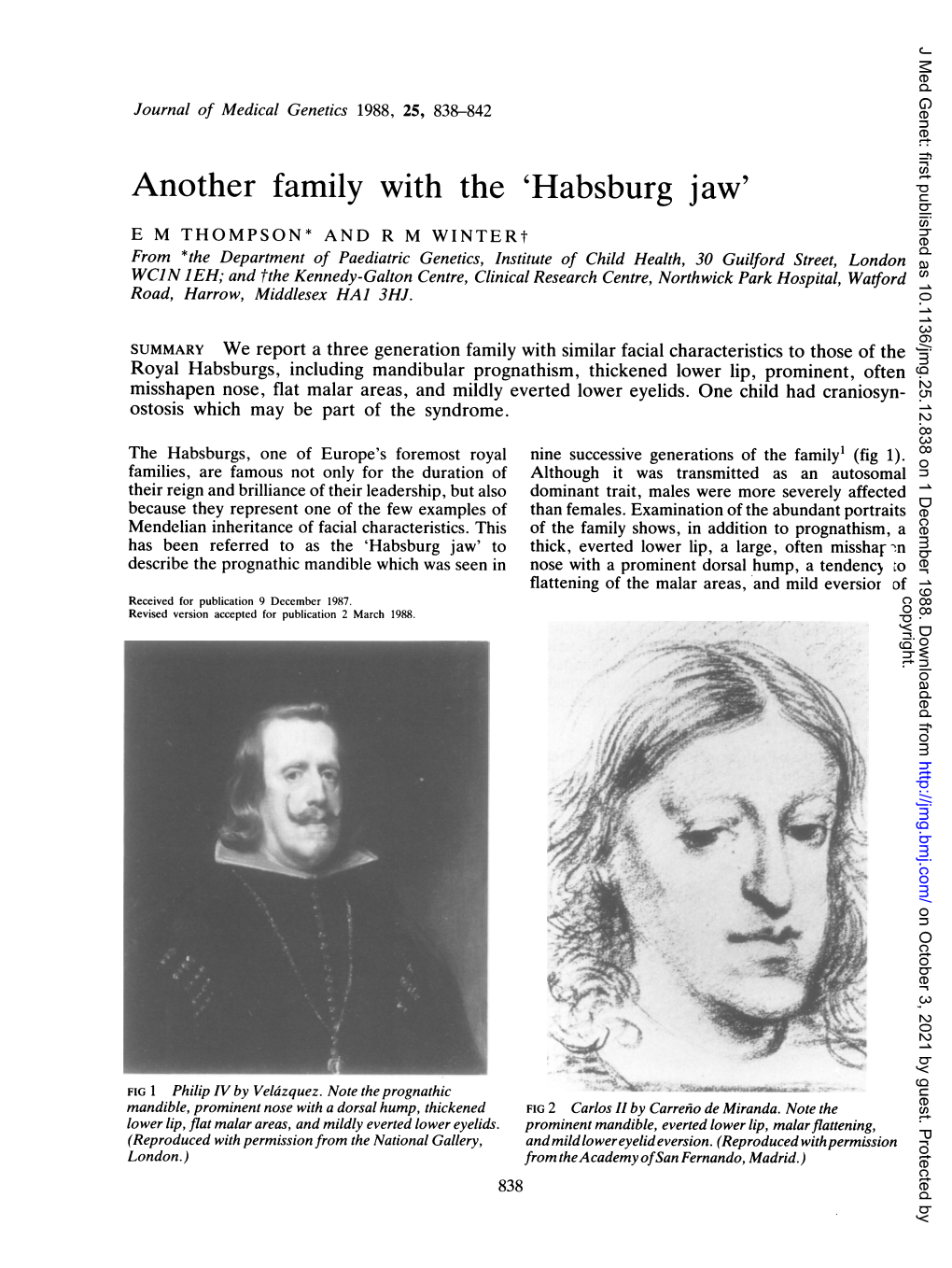 Another Family with the 'Habsburg Jaw'