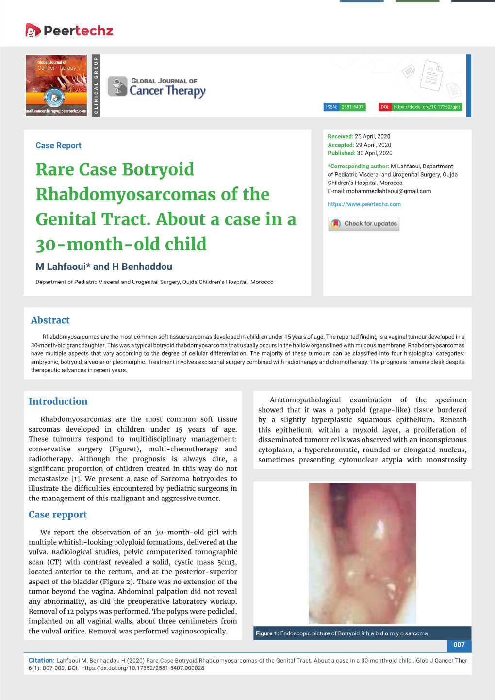 Rare Case Botryoid Rhabdomyosarcomas of the Genital Tract