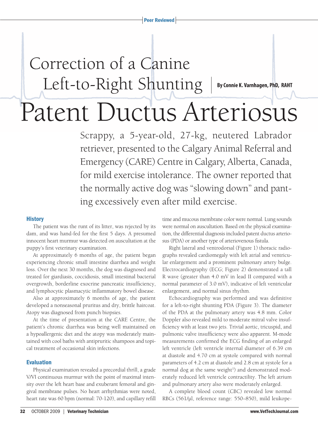 Patent Ductus Arteriosus