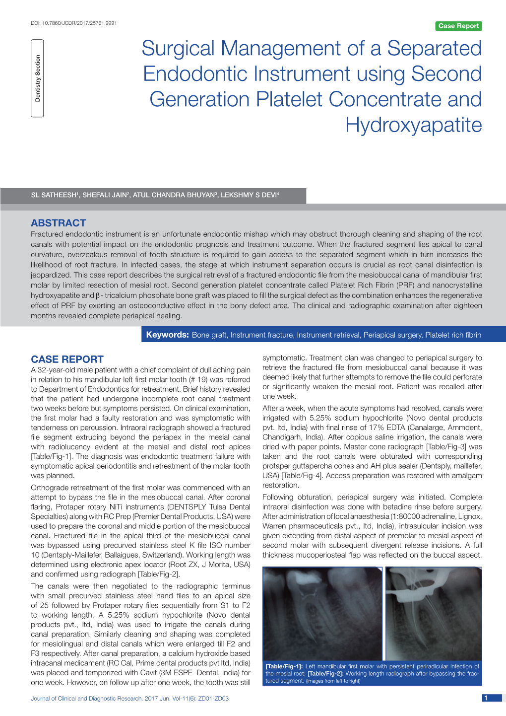 Surgical Management of a Separated Endodontic Instrument Using