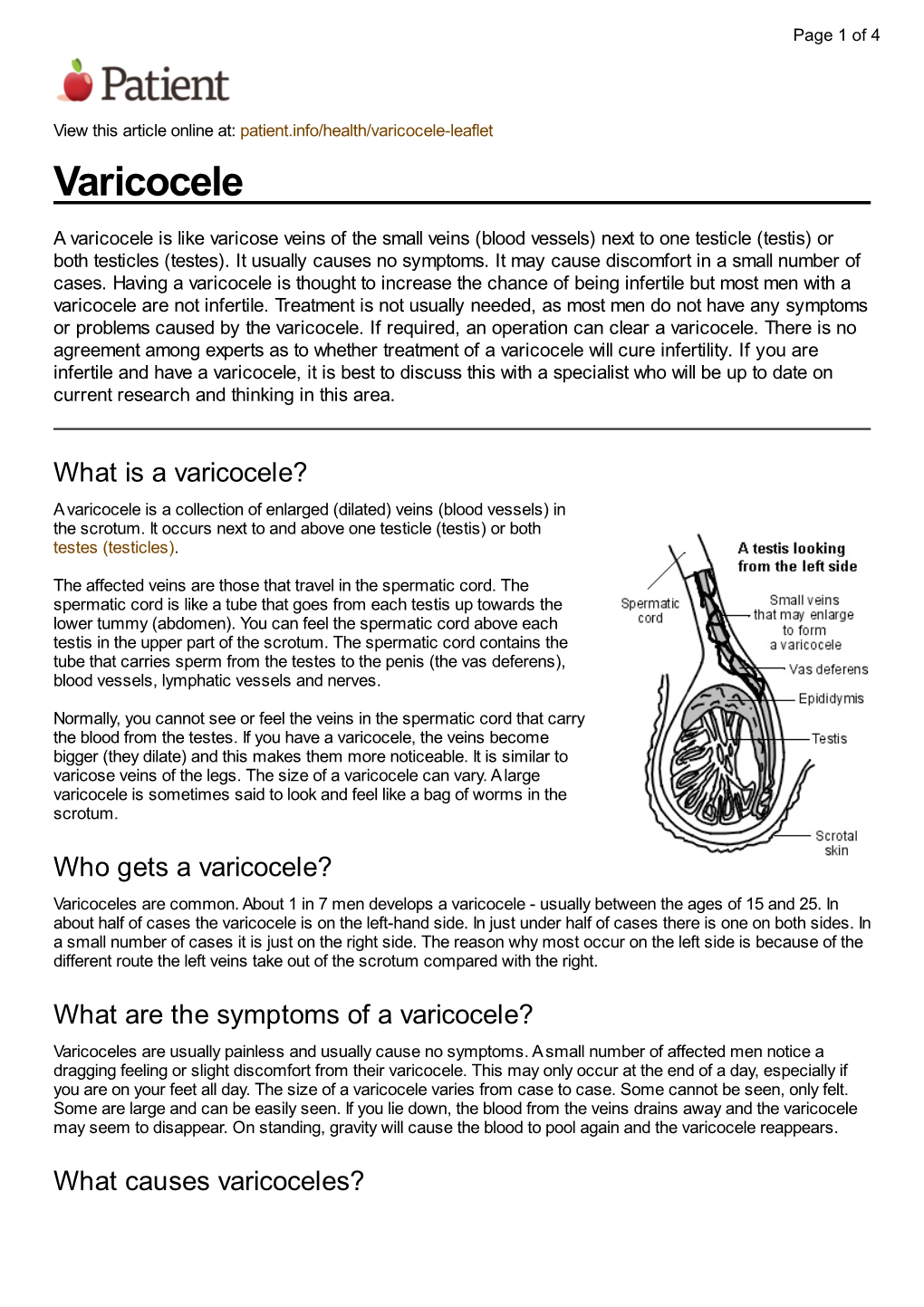 Varicocele.Pdf