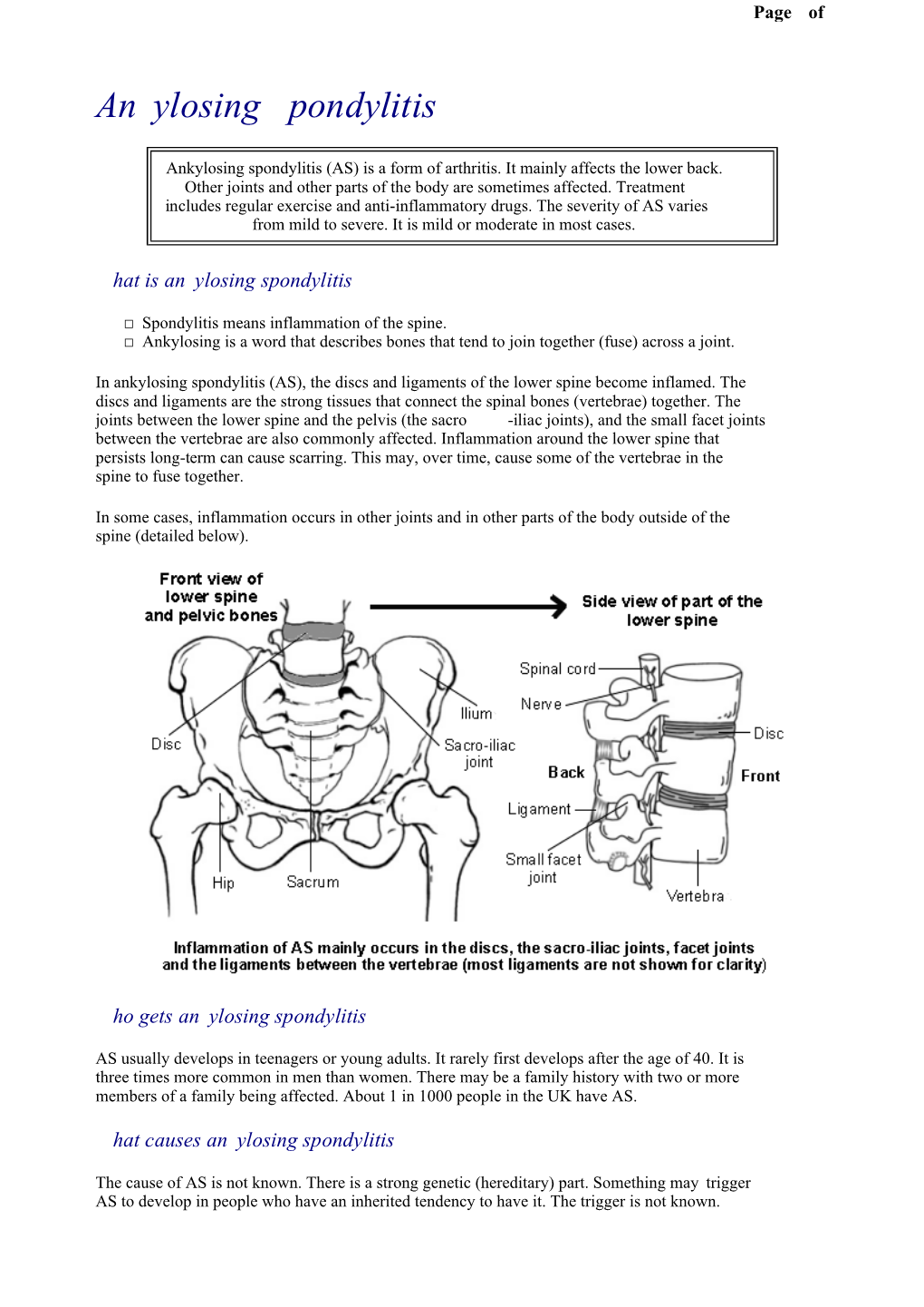 Ankylosing Spondylitis