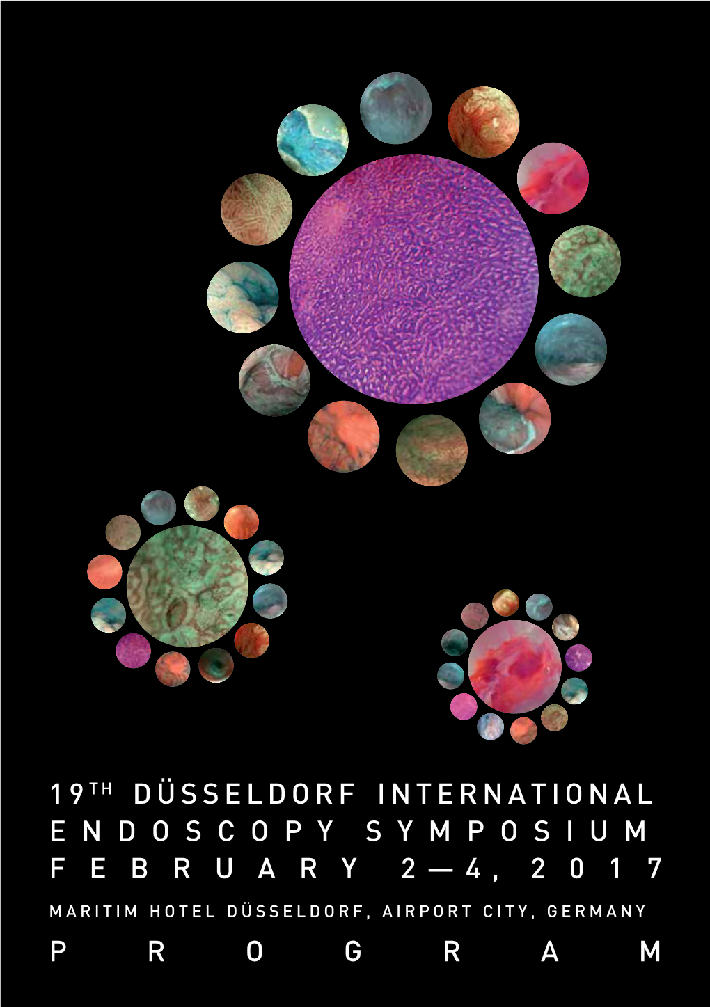 19Th Düsseldorf International Endoscopy Symposium February 2 — 4 , 2017