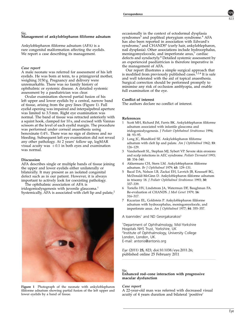 Cone Interaction with Progressive Macular Dysfunction