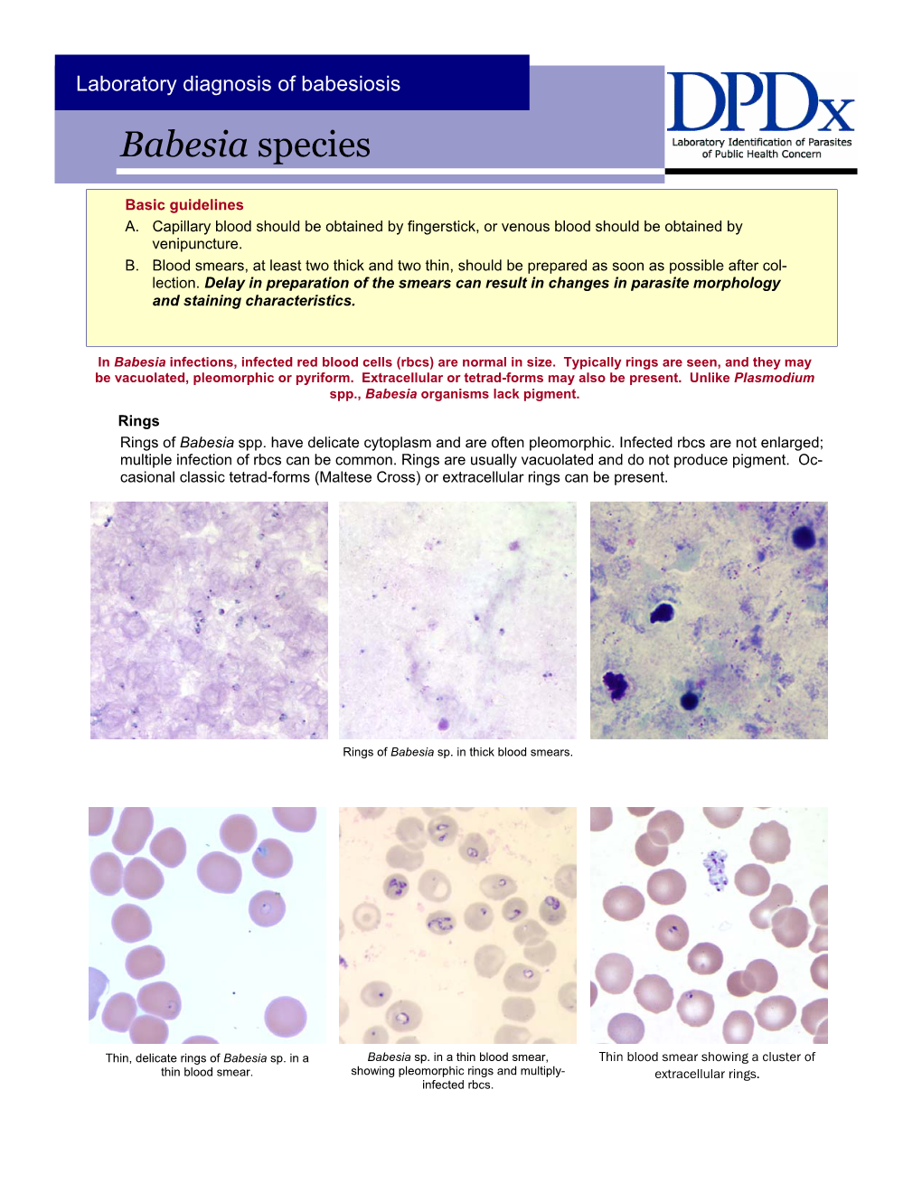 Babesia Species