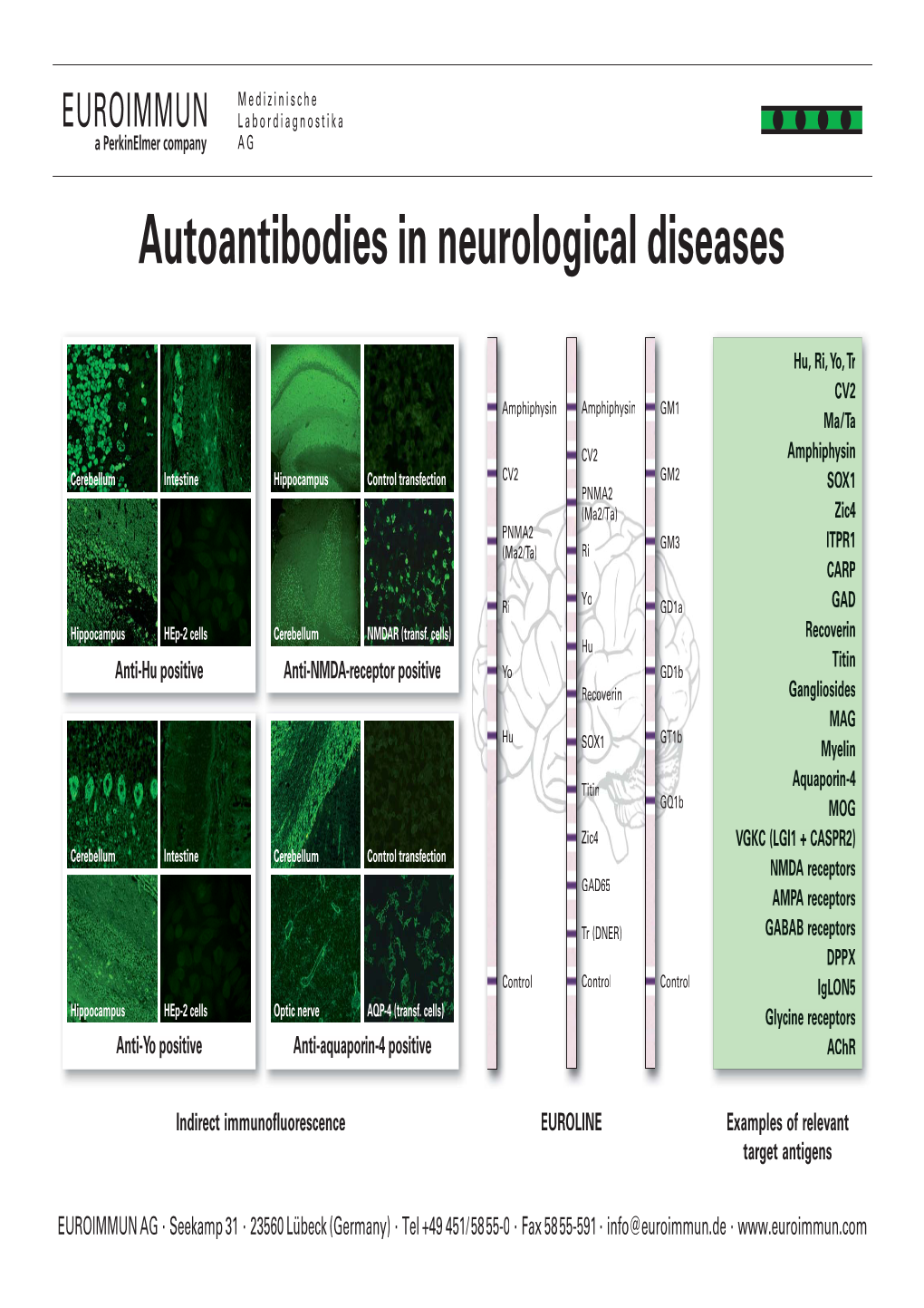 Autoantibodies in Neurological Diseases