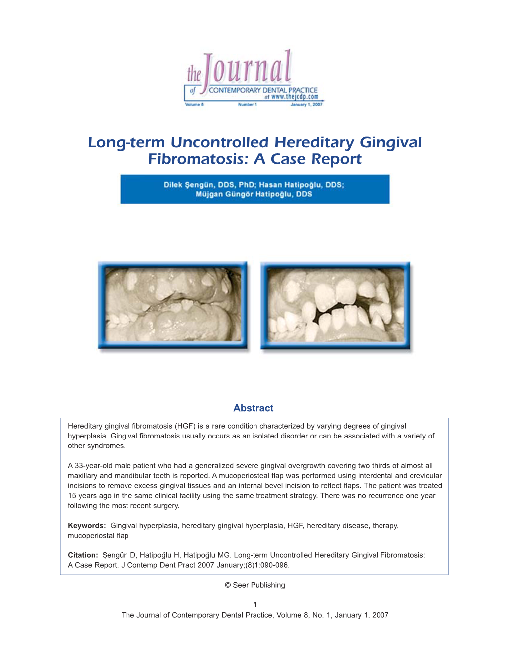 Long-Term Uncontrolled Hereditary Gingival Fibromatosis: a Case Report