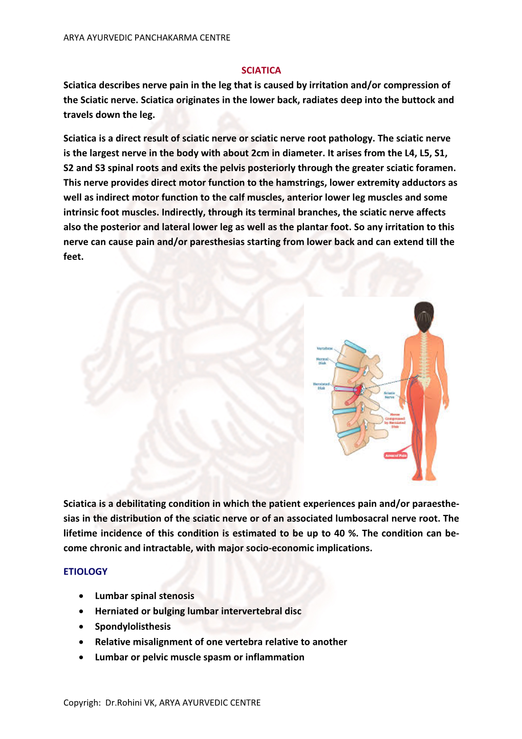 SCIATICA Sciatica Describes Nerve Pain in the Leg That Is Caused by Irritation And/Or Compression of the Sciatic Nerve