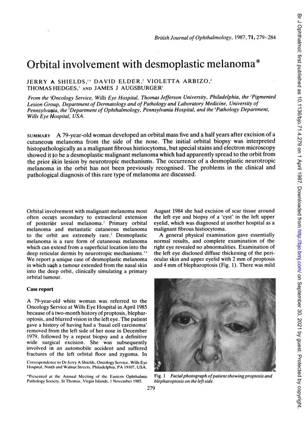 Orbital Involvement with Desmoplastic Melanoma*