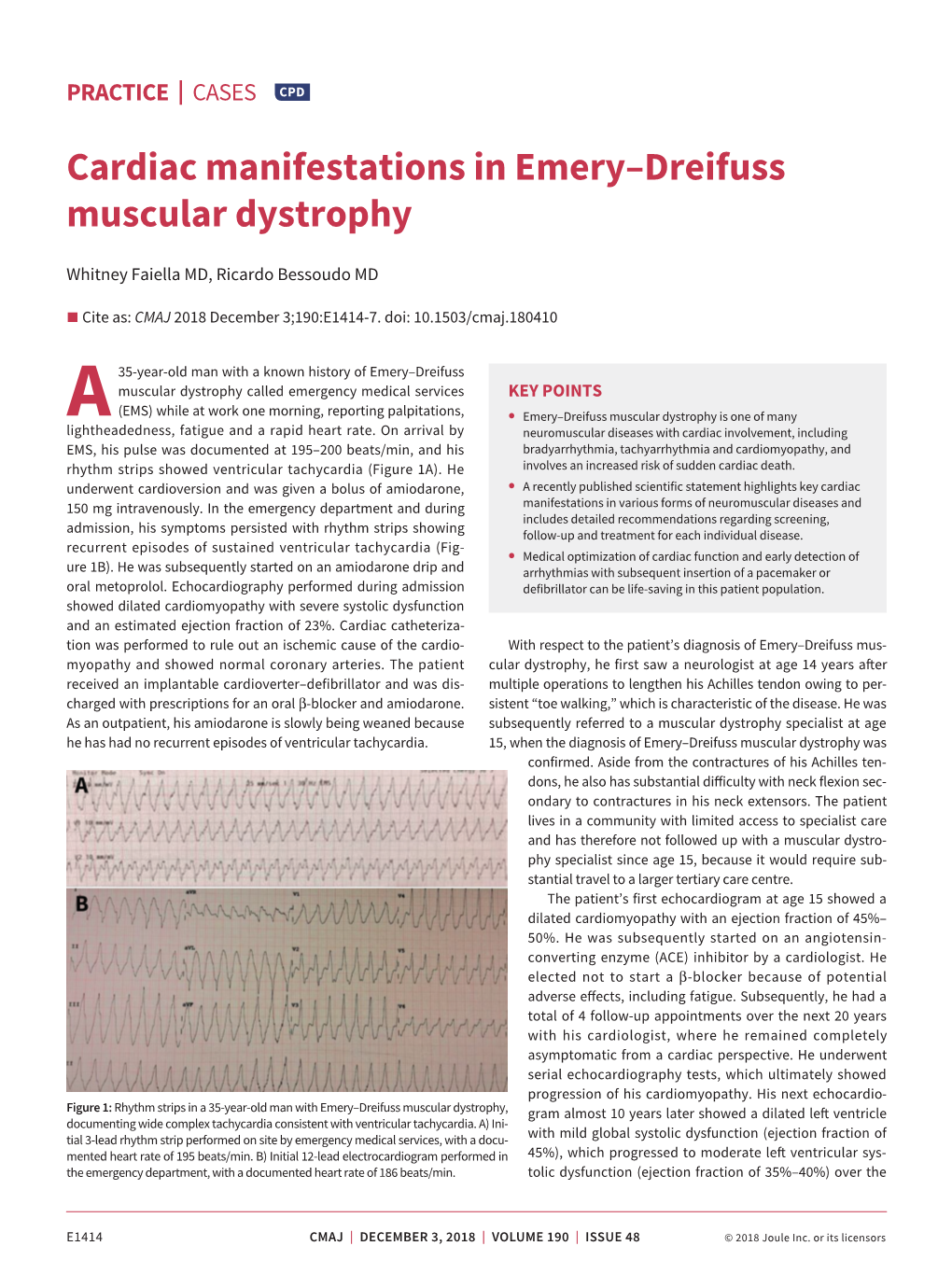 Cardiac Manifestations in Emery–Dreifuss Muscular Dystrophy