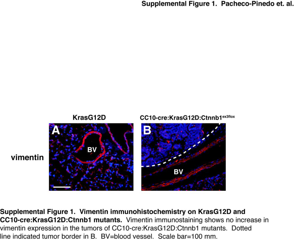 Supplemental Figure 1. Vimentin