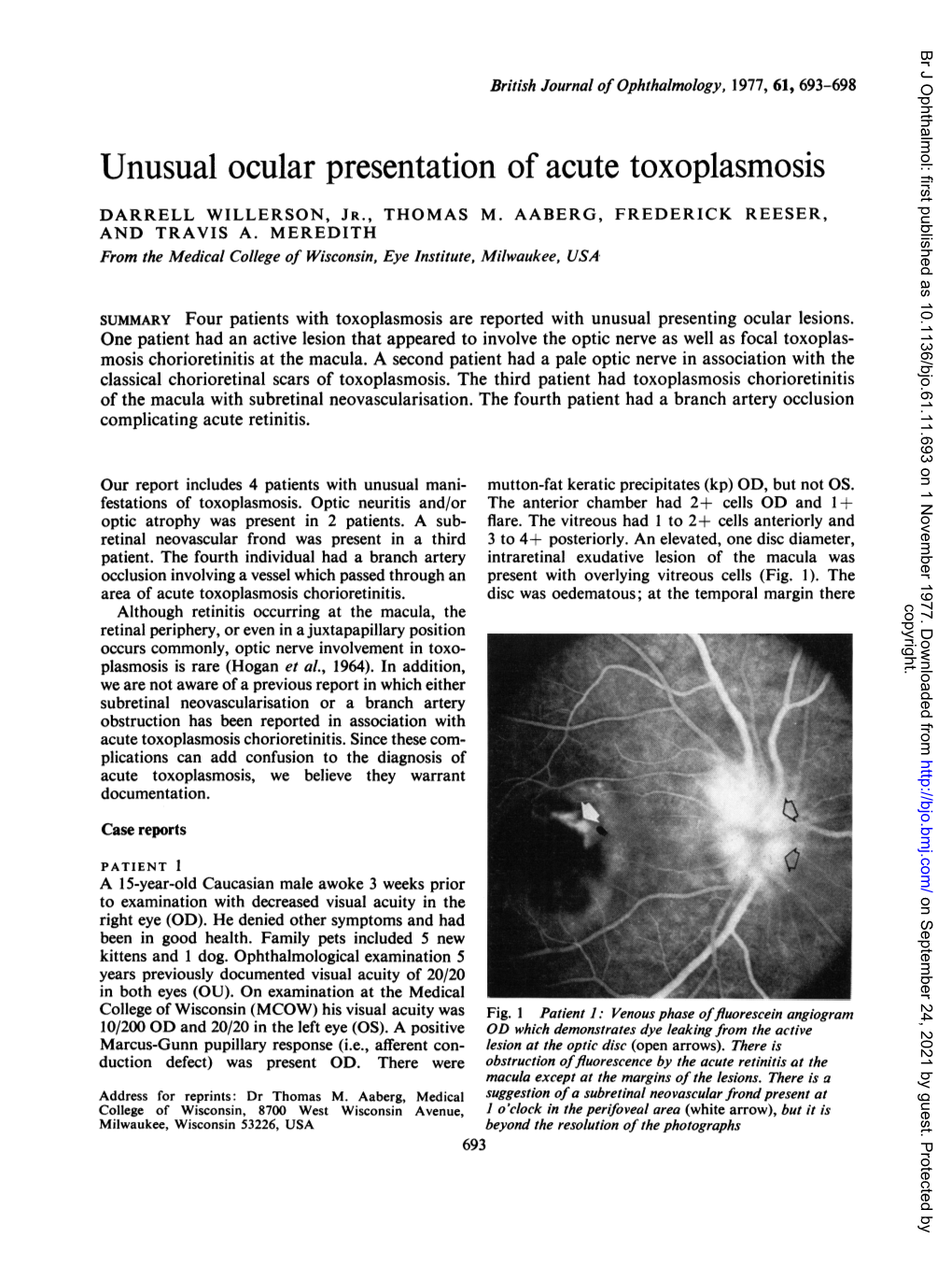 Unusual Ocular Presentation Ofacute Toxoplasmosis 697