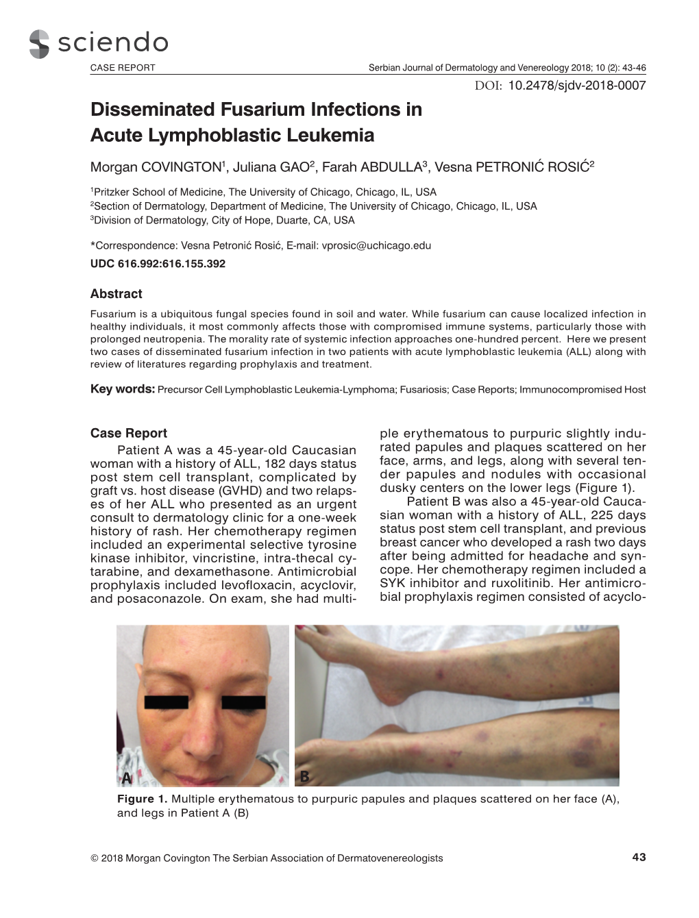 Disseminated Fusarium Infections in Acute Lymphoblastic Leukemia