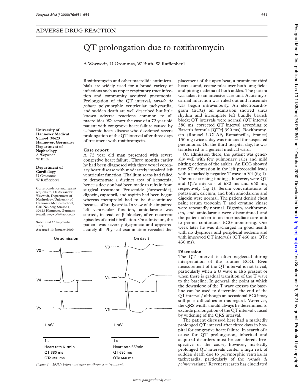 QT Prolongation Due to Roxithromycin