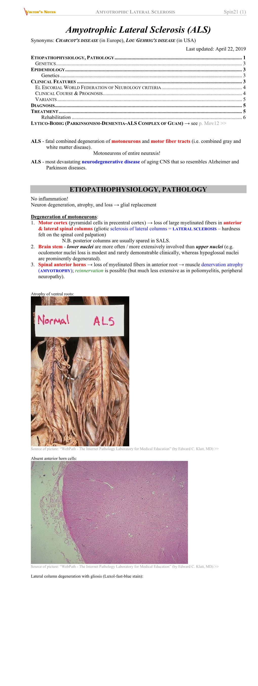 AMYOTROPHIC LATERAL SCLEROSIS Spin21 (1)