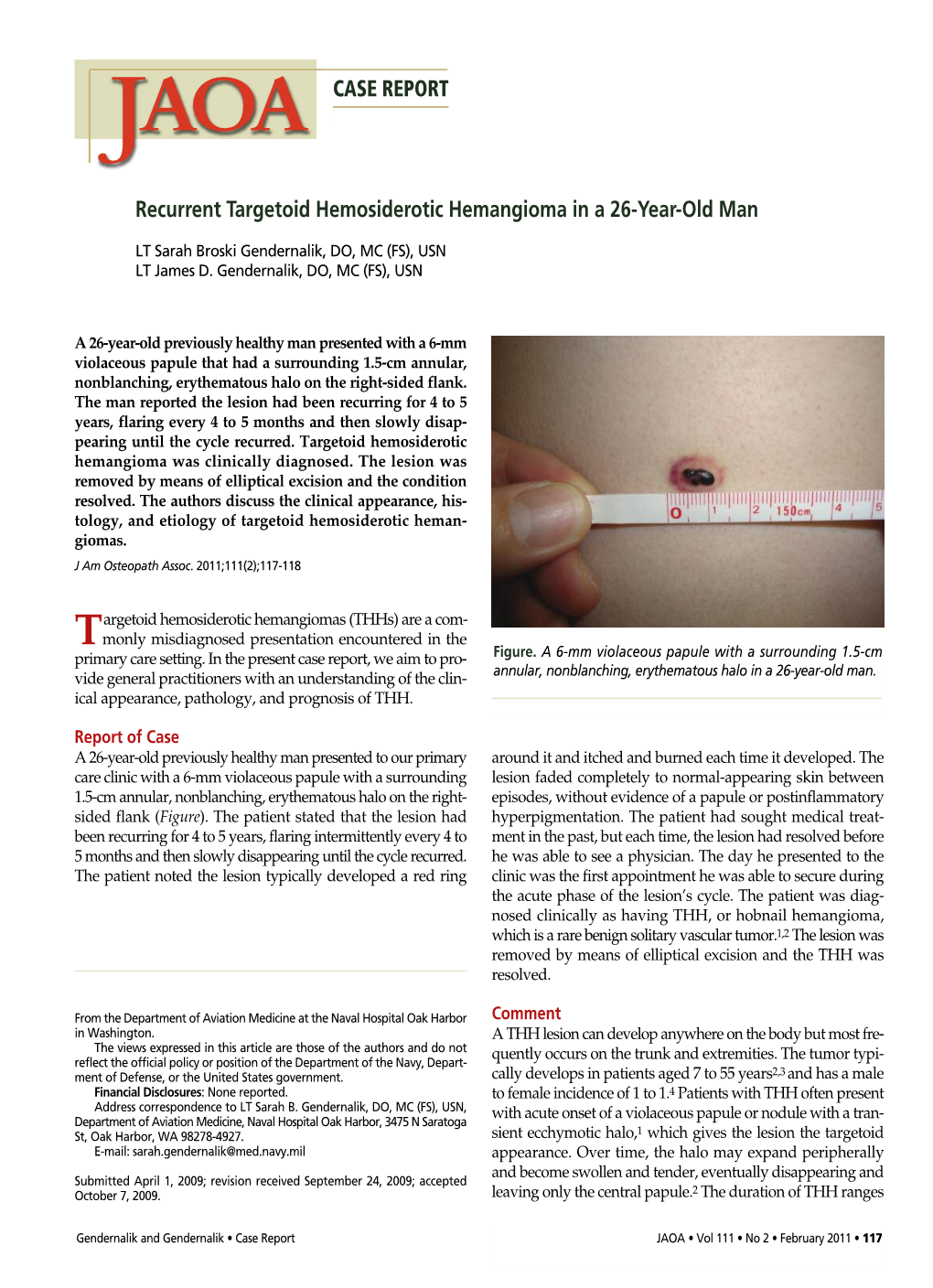 Recurrent Targetoid Hemosiderotic Hemangioma in a 26-Year-Old Man