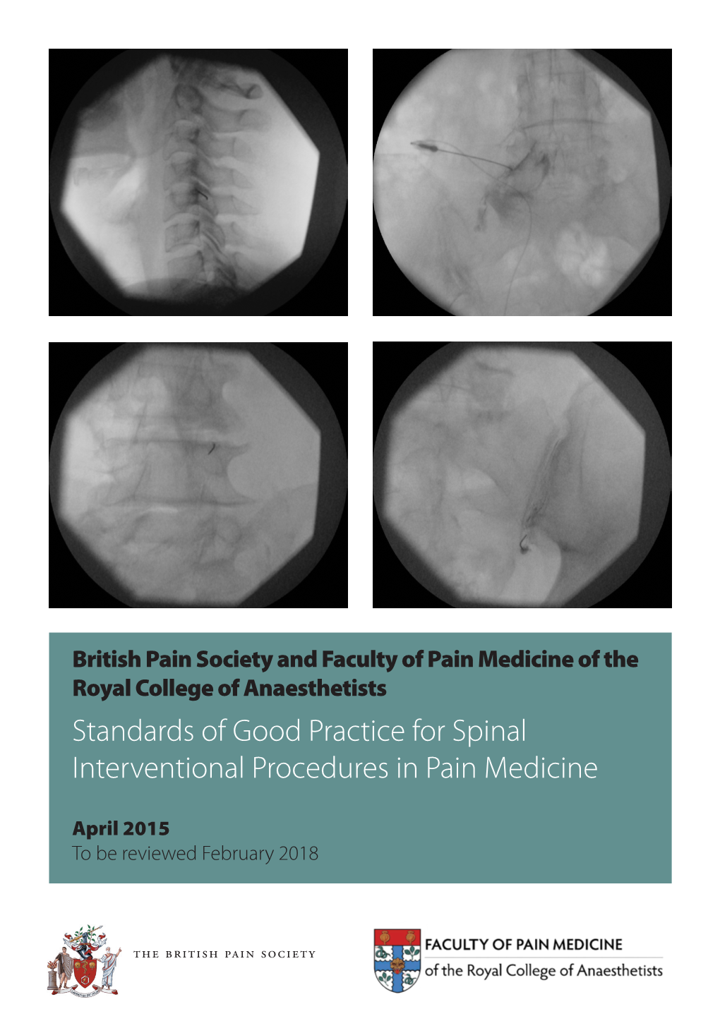 Standards of Good Practice for Spinal Interventional Procedures in Pain Medicine