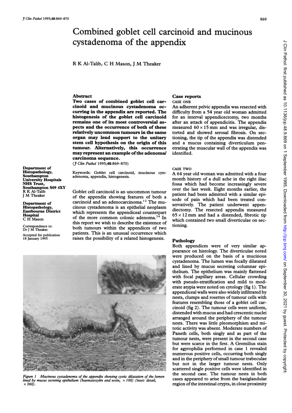 Combined Goblet Cellcarcinoid and Mucinous Cystadenoma of The