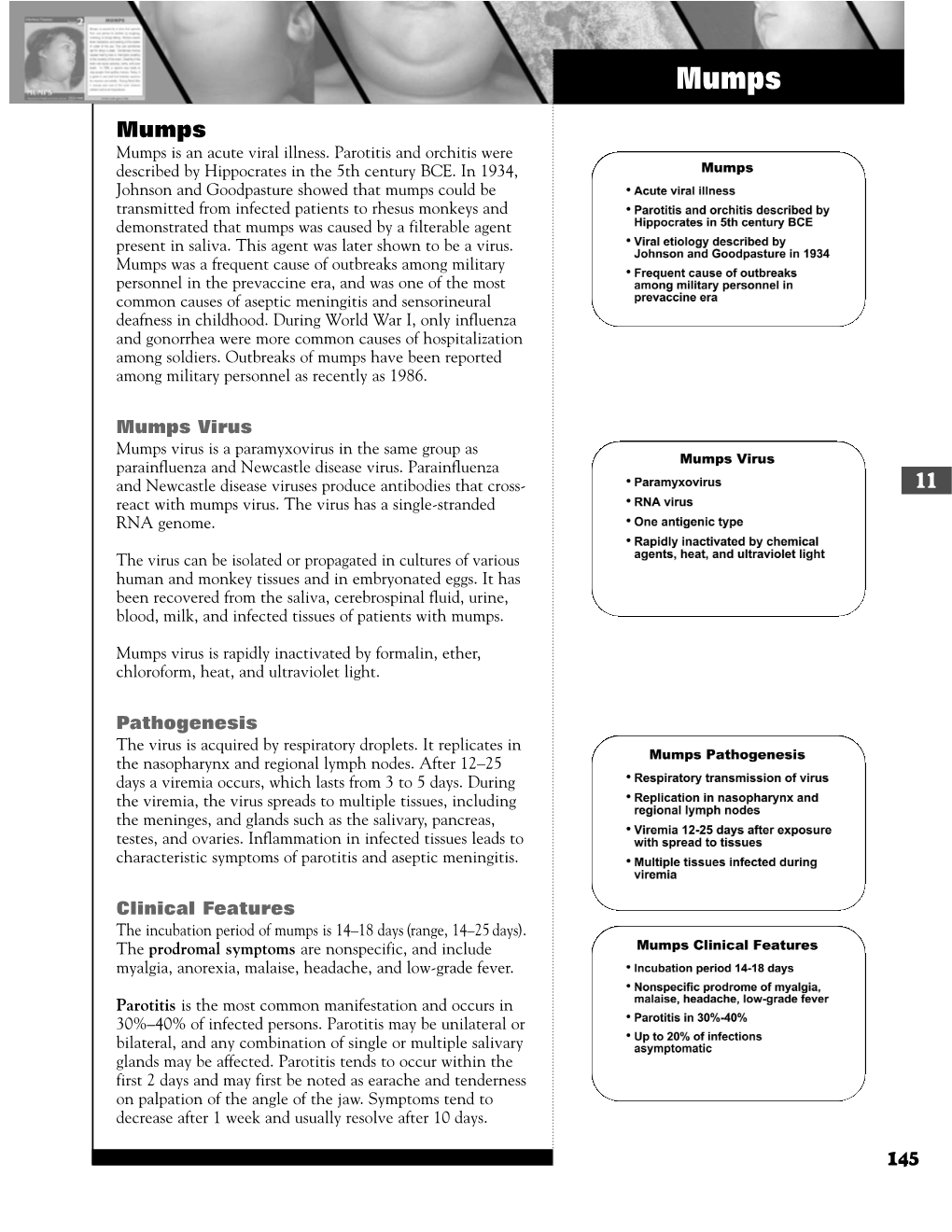 Mumps Virus Pathogenesis Clinical Features