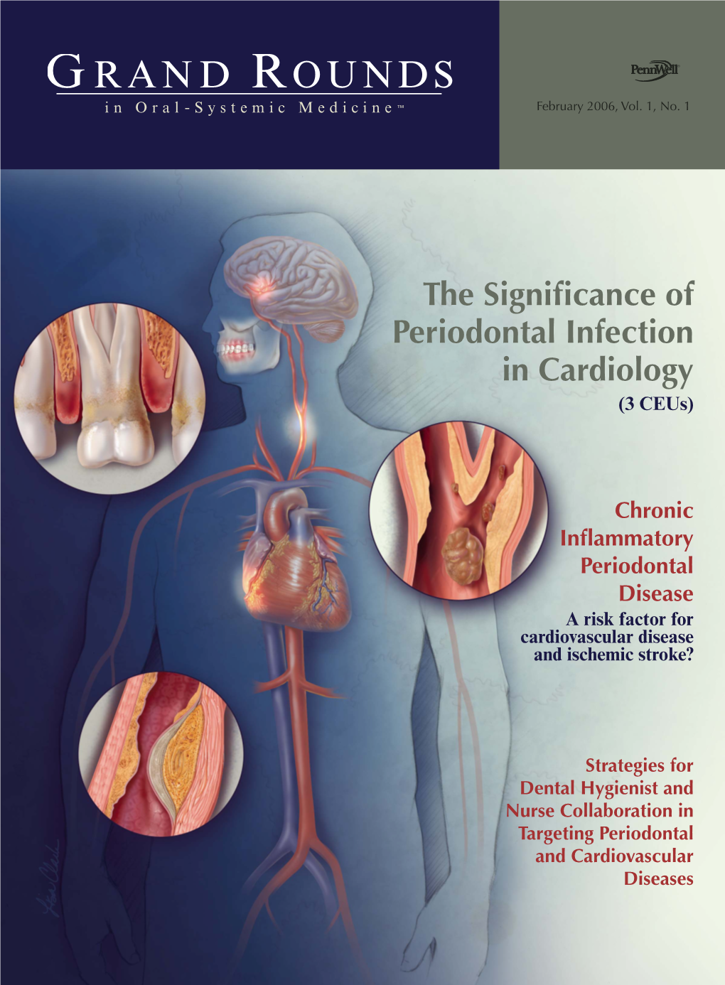 Cardiovascular Disease and Ischemic Stroke?