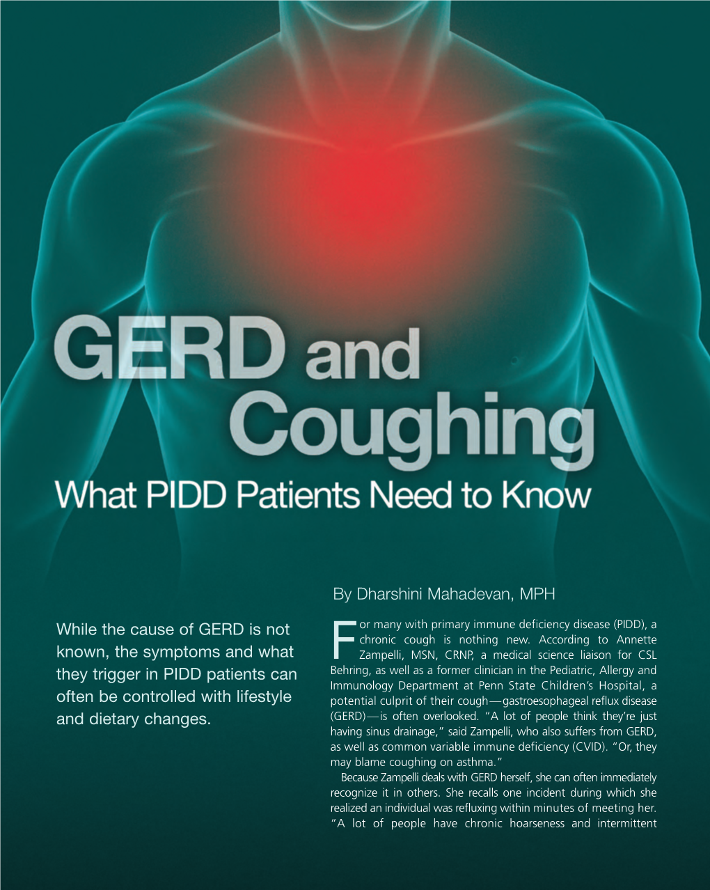 GERD and Coughing, What PIDD Patients Need to Know