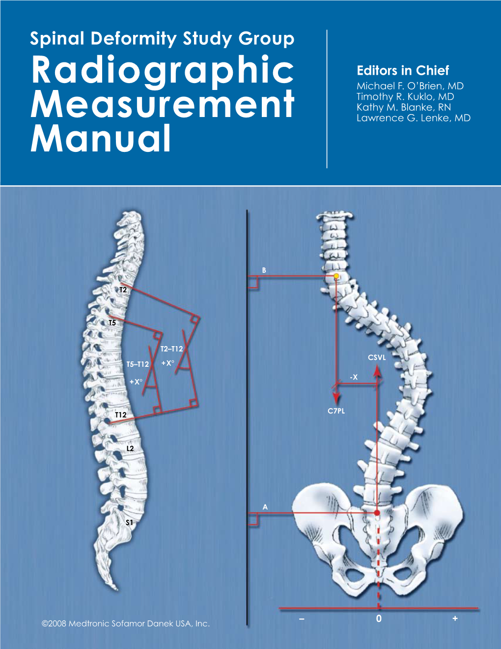 Spinal Deformity Study Group