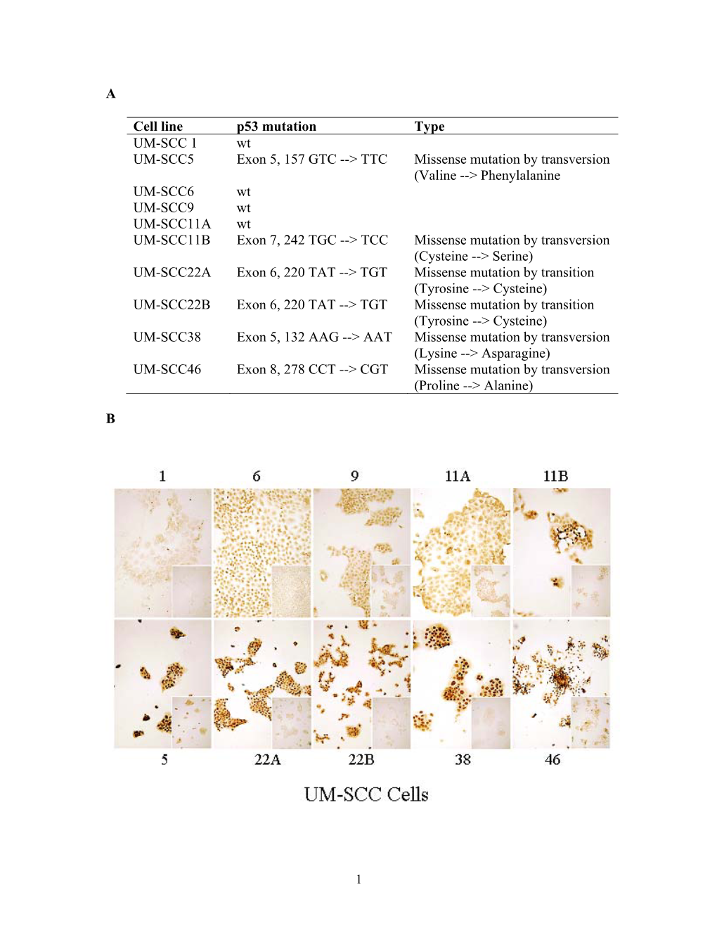 A Cell Line P53 Mutation Type UM