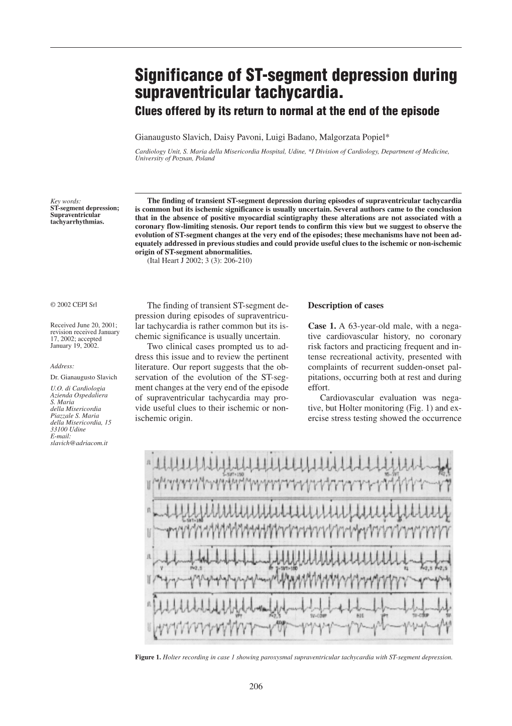 Significance of ST-Segment Depression During Supraventricular Tachycardia