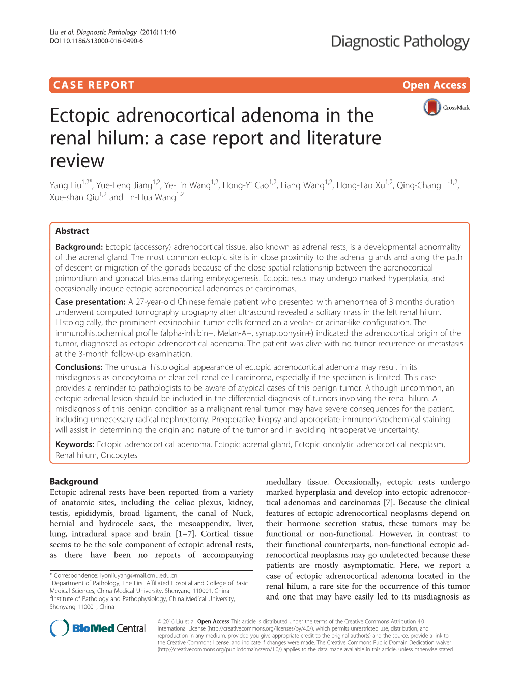 Ectopic Adrenocortical Adenoma in the Renal Hilum