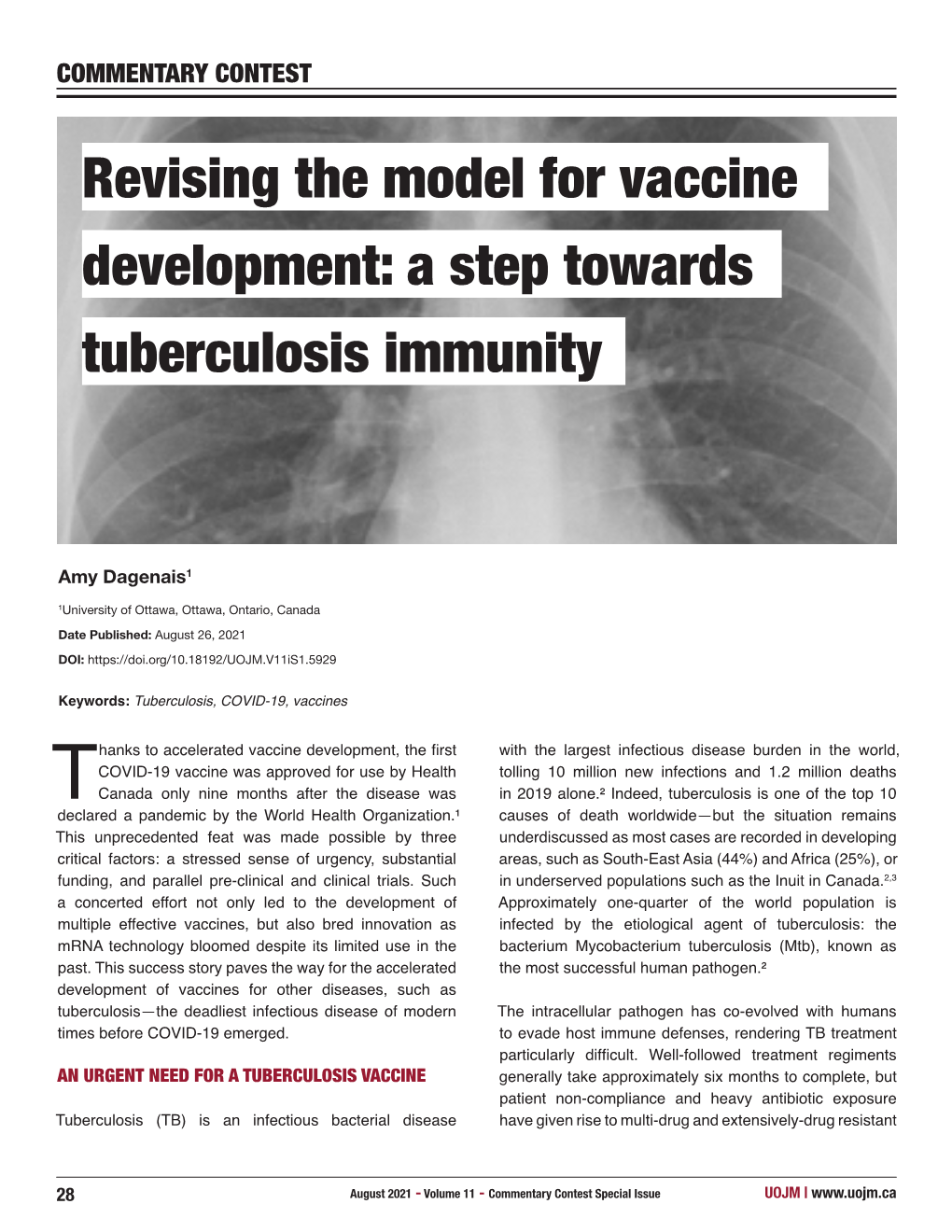 A Step Towards Revising the Model for Vaccine Tuberculosis Immunity