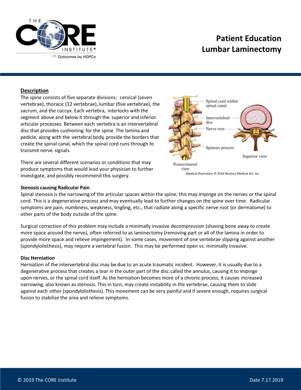 Lumbar Laminectomy