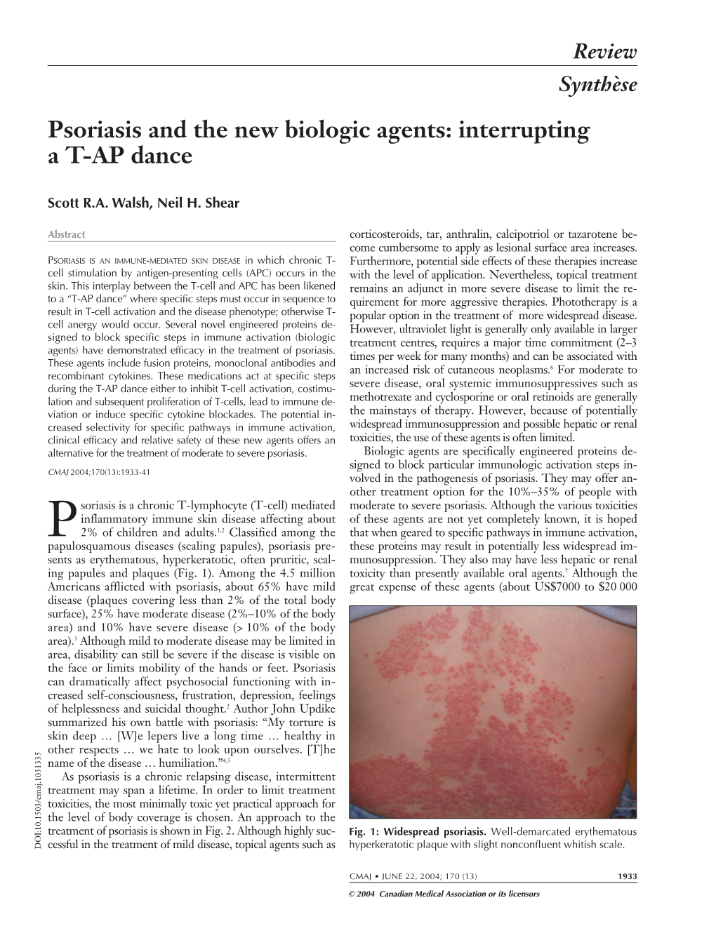 Psoriasis and the New Biologic Agents: Interrupting a T-AP Dance