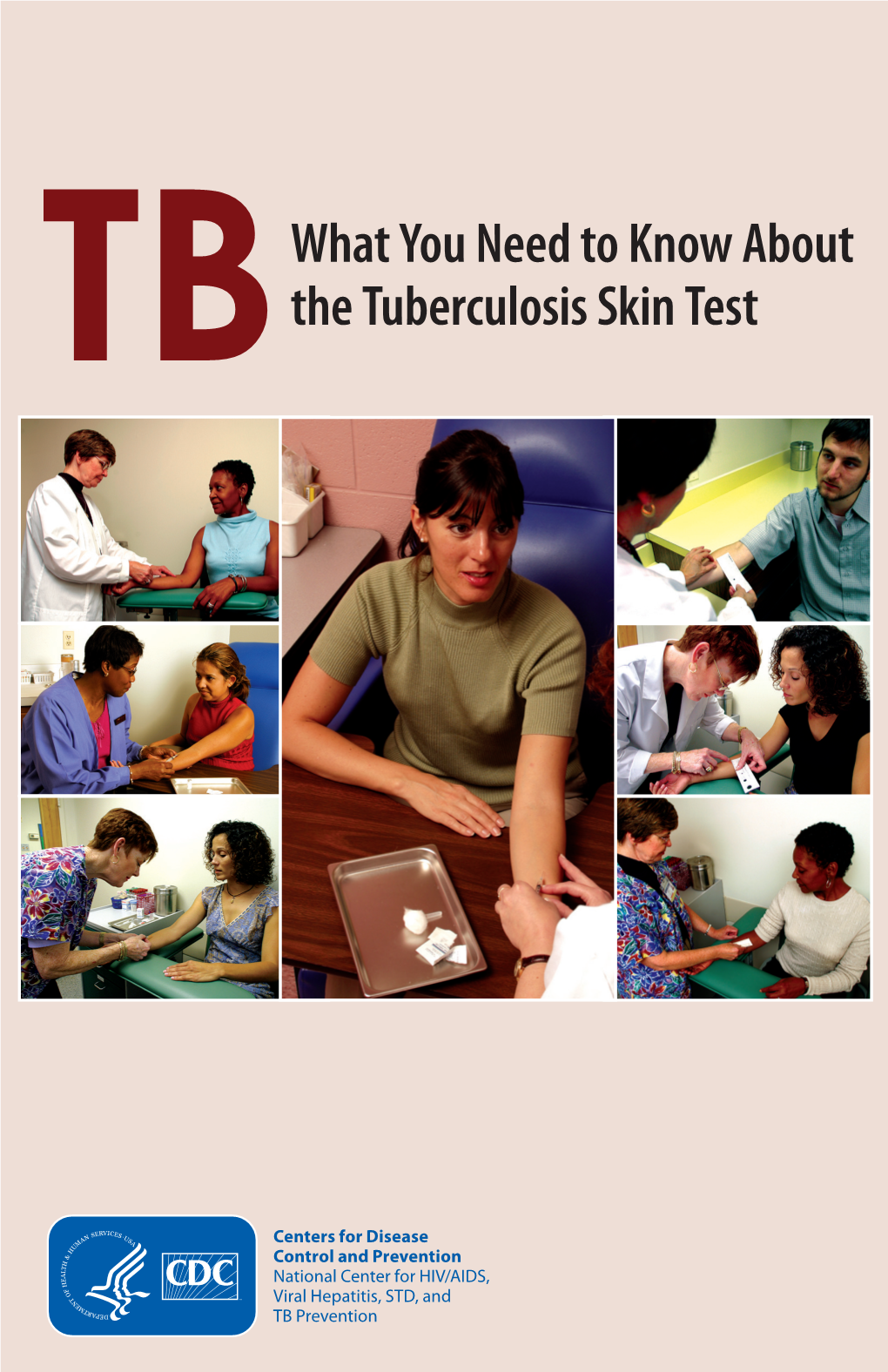 Tbwhat You Need to Know About the Tuberculosis Skin Test