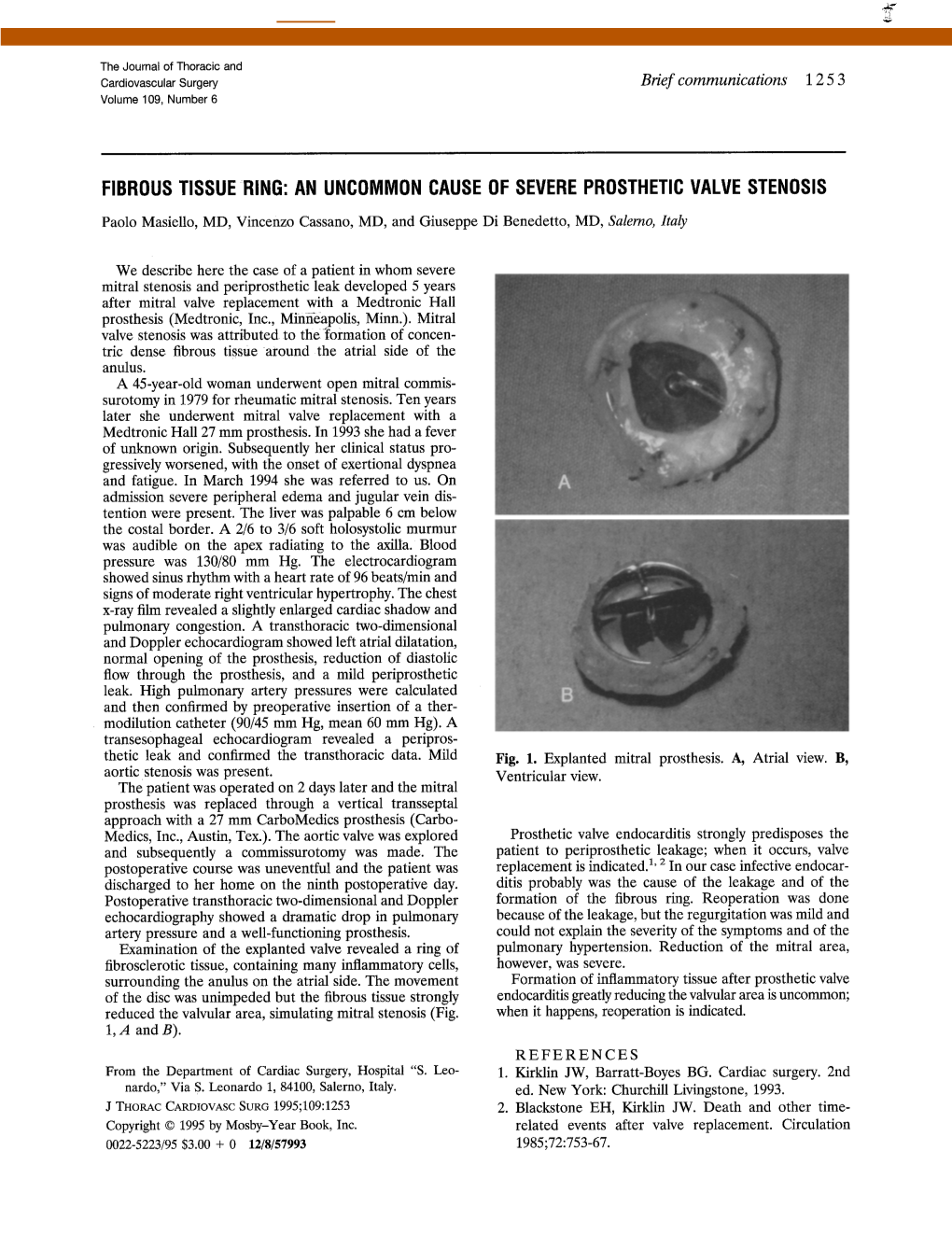Fibrous Tissue Ring: an Uncommon Cause of Severe Prosthetic Valve Stenosis