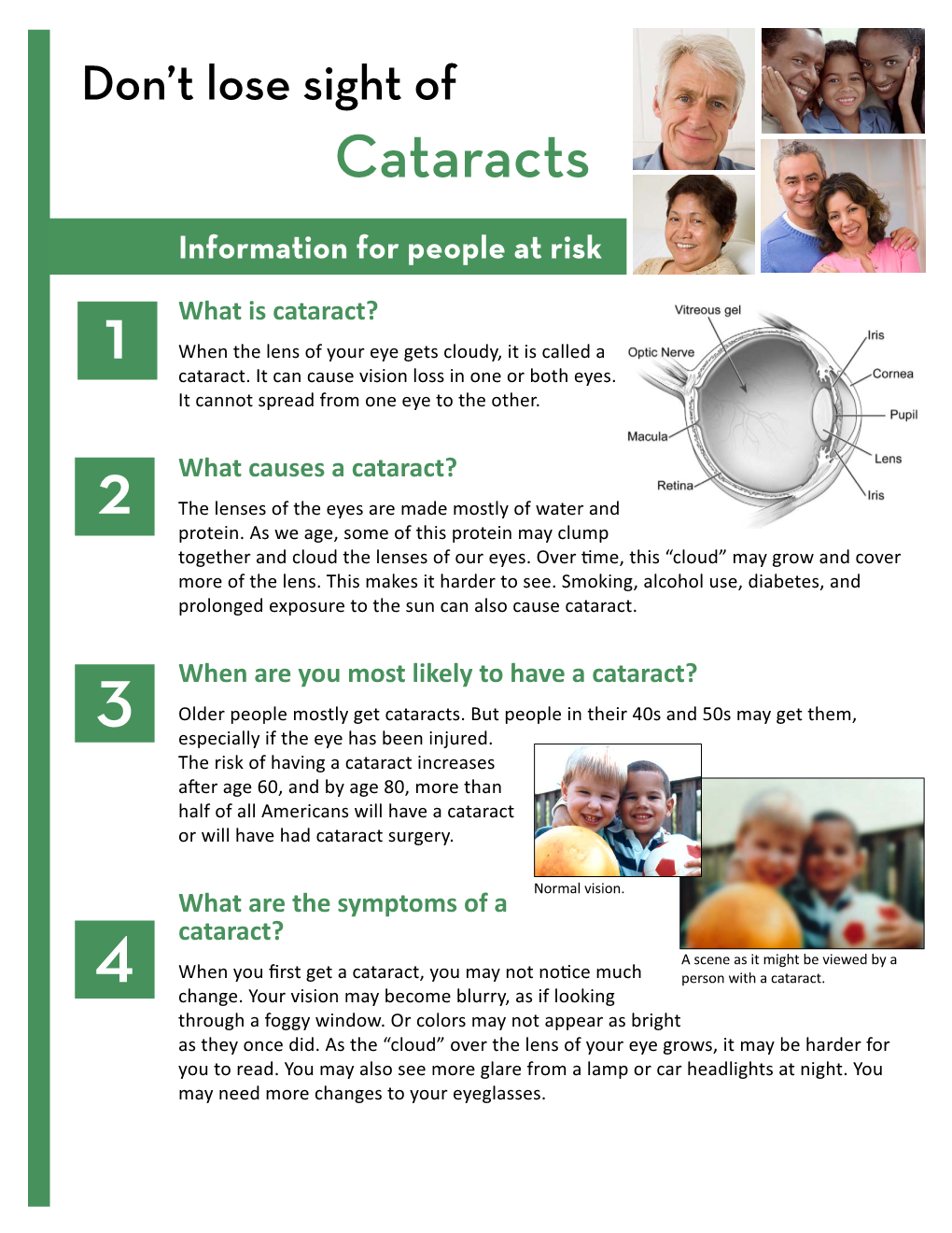 FAQ: Cataracts