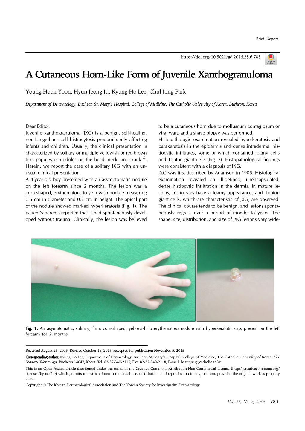 A Cutaneous Horn-Like Form of Juvenile Xanthogranuloma