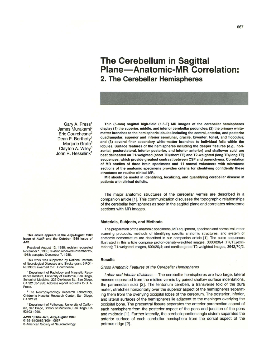 The Cerebellum in Sagittal Plane-Anatomic-MR Correlation: 2