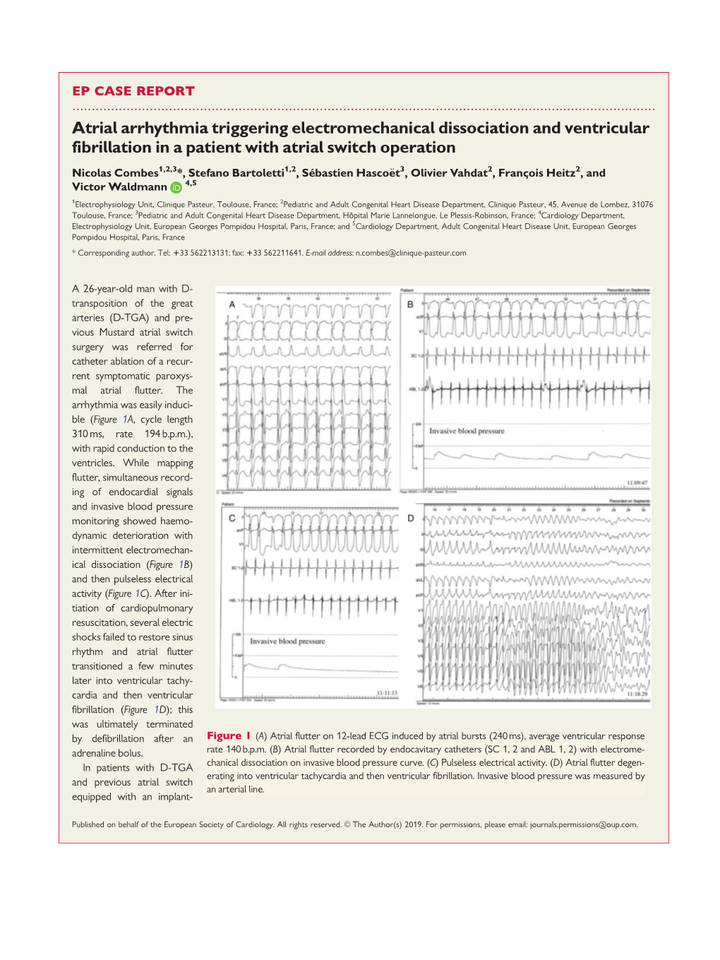 Atrial Arrhythmia Triggering Electromechanical Dissociation And