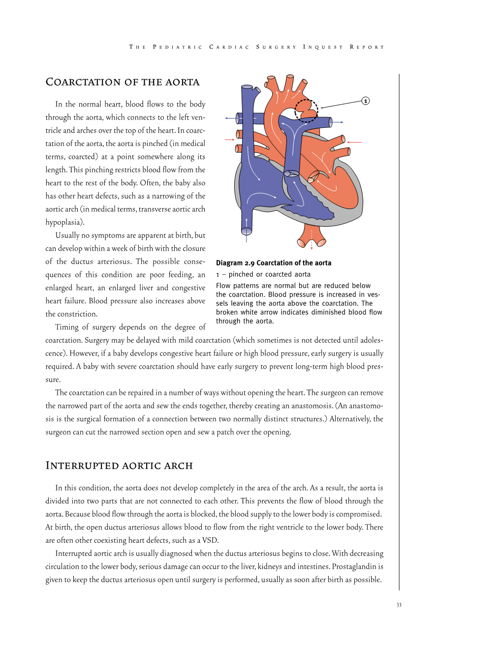 Coarctation of the Aorta Interrupted Aortic Arch