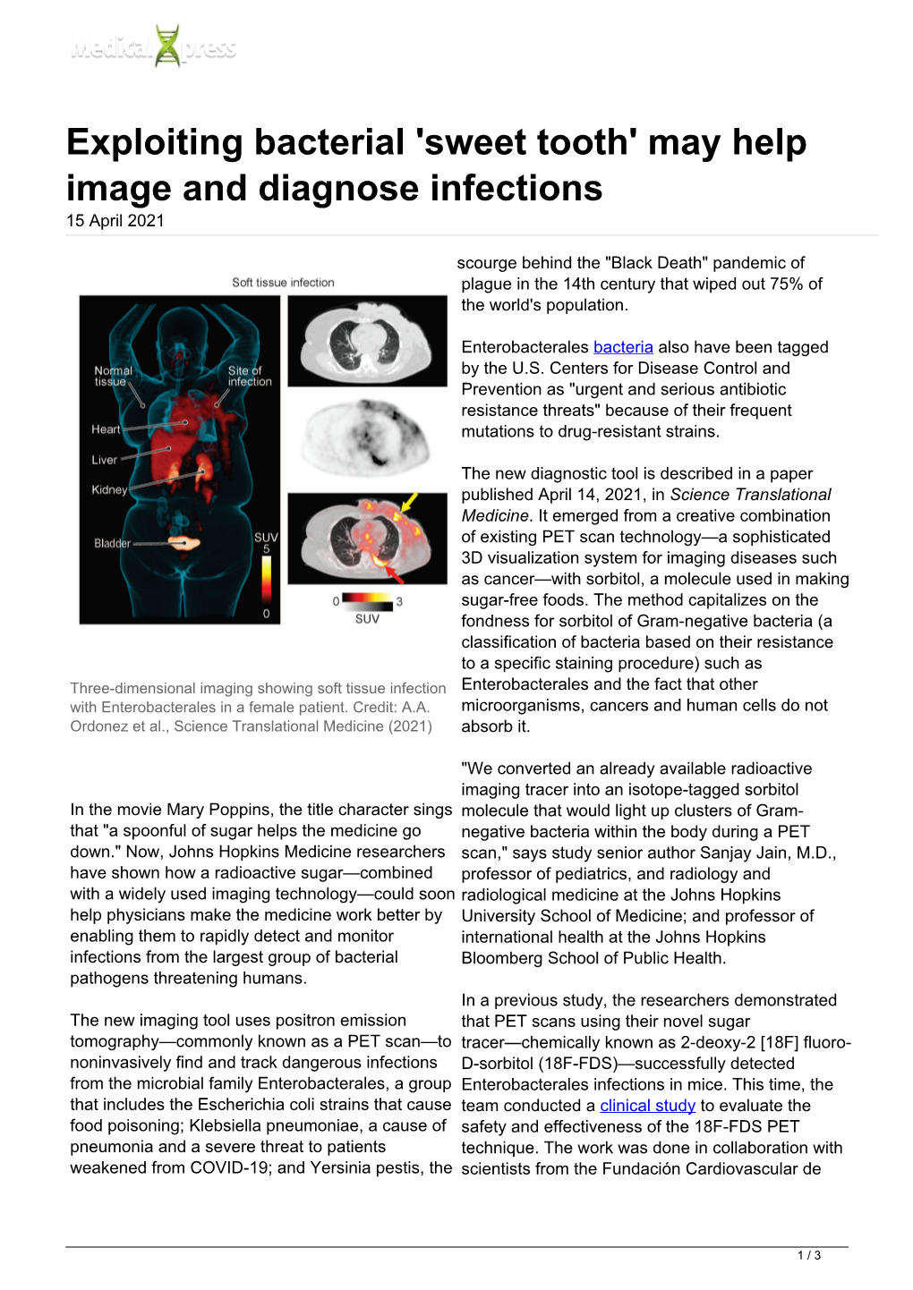 Exploiting Bacterial 'Sweet Tooth' May Help Image and Diagnose Infections 15 April 2021