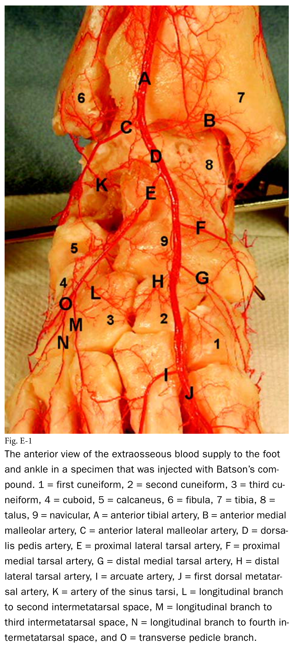 The Anterior View of the Extraosseous Blood Supply to the Foot and Ankle in a Specimen That Was Injected with Batson's Com- Po