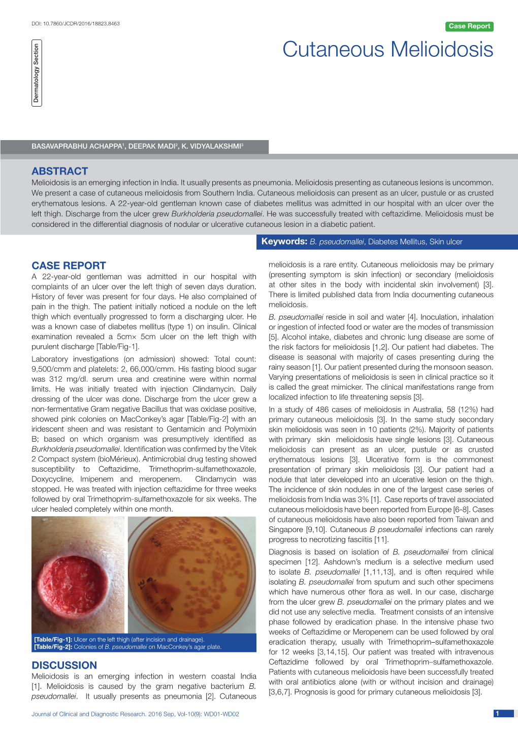 Cutaneous Melioidosis Dermatology Section